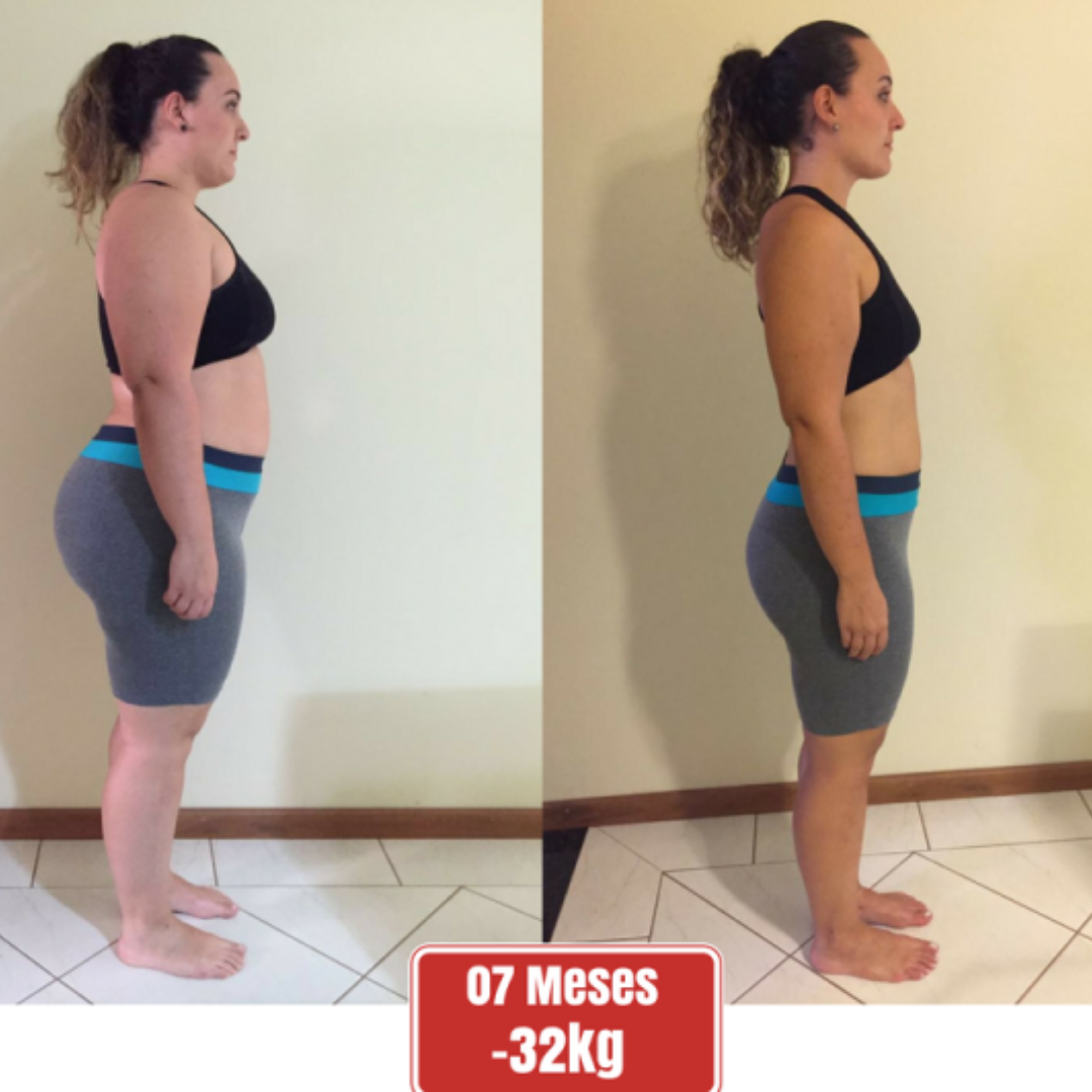 Antes e Depois - Cliente 3