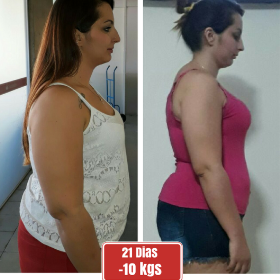 Antes e Depois - Cliente 2